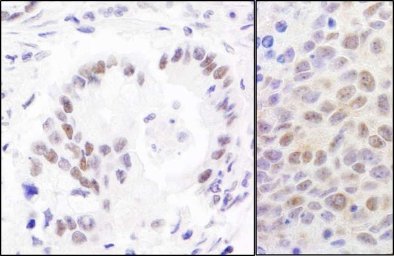 Polyclonal Rabbit anti-Human RPA70 / RPA1 Antibody (aa350-400, IHC, WB)