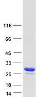 Human TPD52L2 / HD54 Protein (Recombinant Myc-DDK (Flag))
