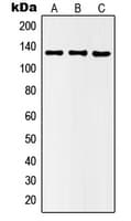 HDAC5 Antibody (phospho-Ser498)