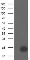 CDKN2B / p15 INK4b Antibody (clone OTI1H5)
