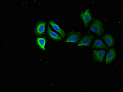 Polyclonal Rabbit anti-Human RPS15 / Ribosomal Protein S15 Antibody (IHC, IF, WB)