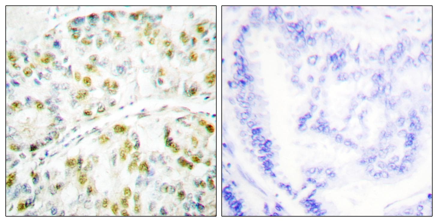 ATXN1 / SCA1 Antibody