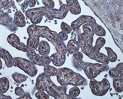 HIF1A / HIF1 Alpha Antibody (aa329-530, clone ESEE122, DY650)