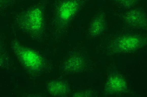 NDN / Necdin Antibody (clone OTI5D1)