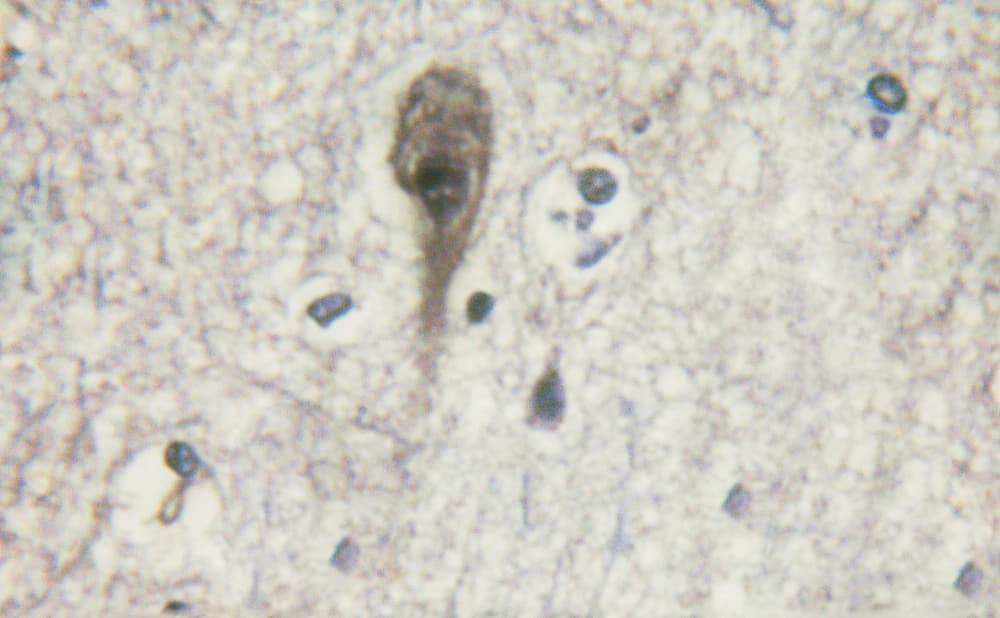 ADRB2 Antibody (phospho-Ser346)