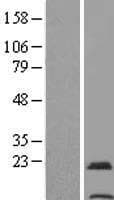 TMEM31 Protein (Over-Expression Lysate Myc-DDK (Flag))