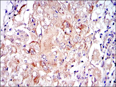 PKN2 Antibody (clone 1D1)