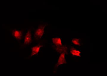 SMC1A / SMC1 Antibody