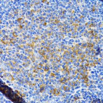 CHAF1B / CAF1 Antibody