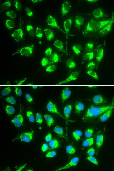 IHC-plus™ SLC22A5 / OCTN2 Antibody