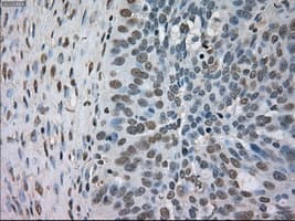 BUB1B / BubR1 Antibody (clone OTI3C7)