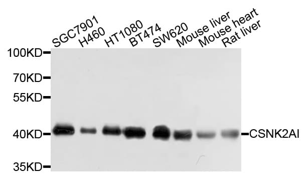 CSNK2A1 Antibody