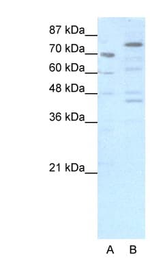 Polyclonal Rabbit anti-Human Eomesodermin / EOMES Antibody (N-Terminus, IHC, WB)