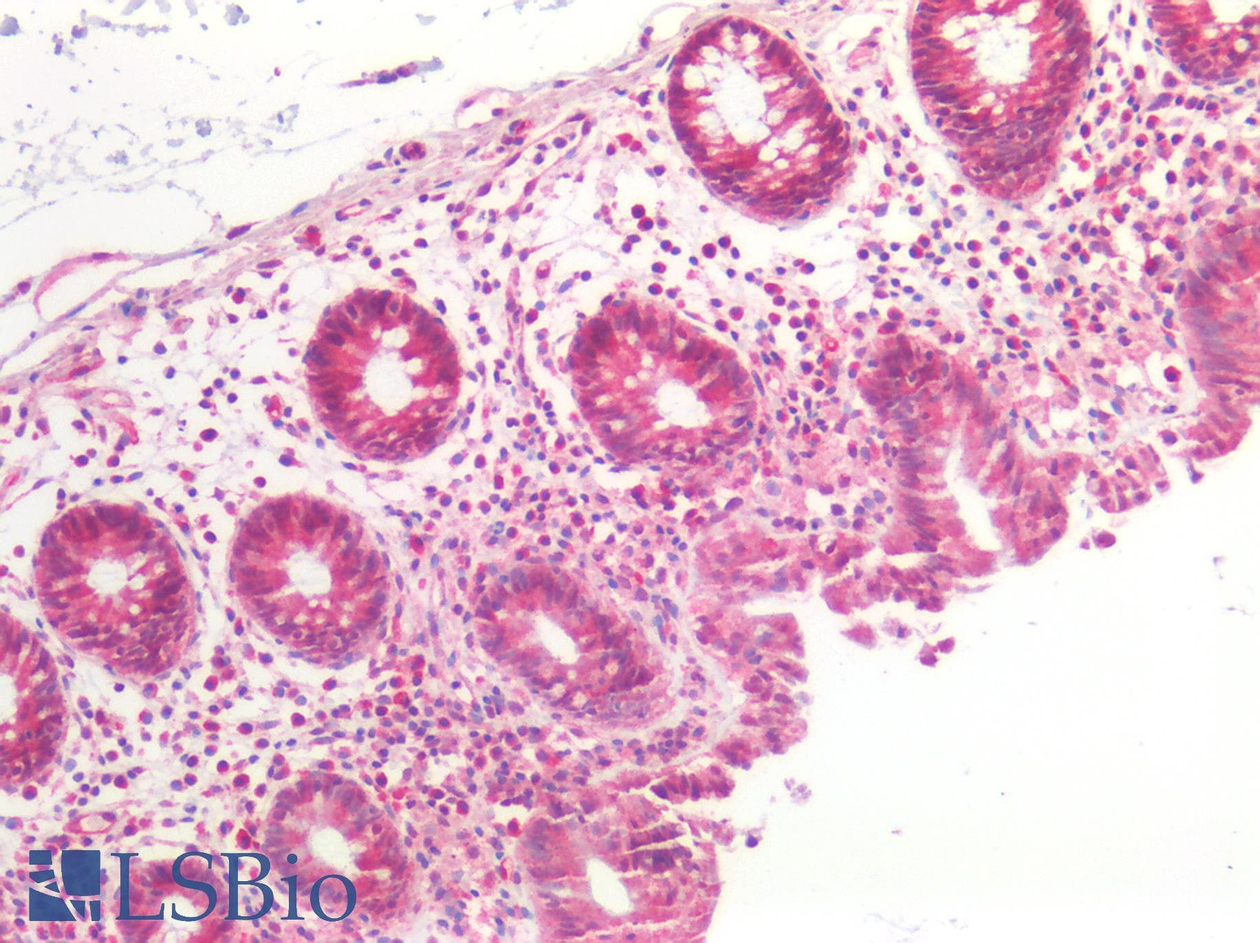 IHC-plus™ Polyclonal Rabbit anti-Human CX3CL1 / Fractalkine Antibody (IHC)