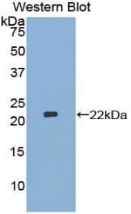 MMP13 Antibody (aa286-462)