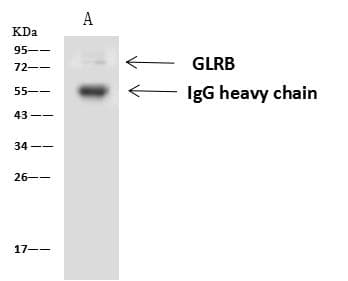 Polyclonal Rabbit anti-Human Spastic / GLRB Antibody (IHC, WB)
