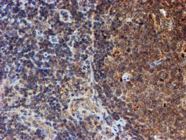 HARS2 Antibody (clone OTI5H2)
