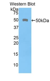CD46 Antibody (aa136-341, Biotin)