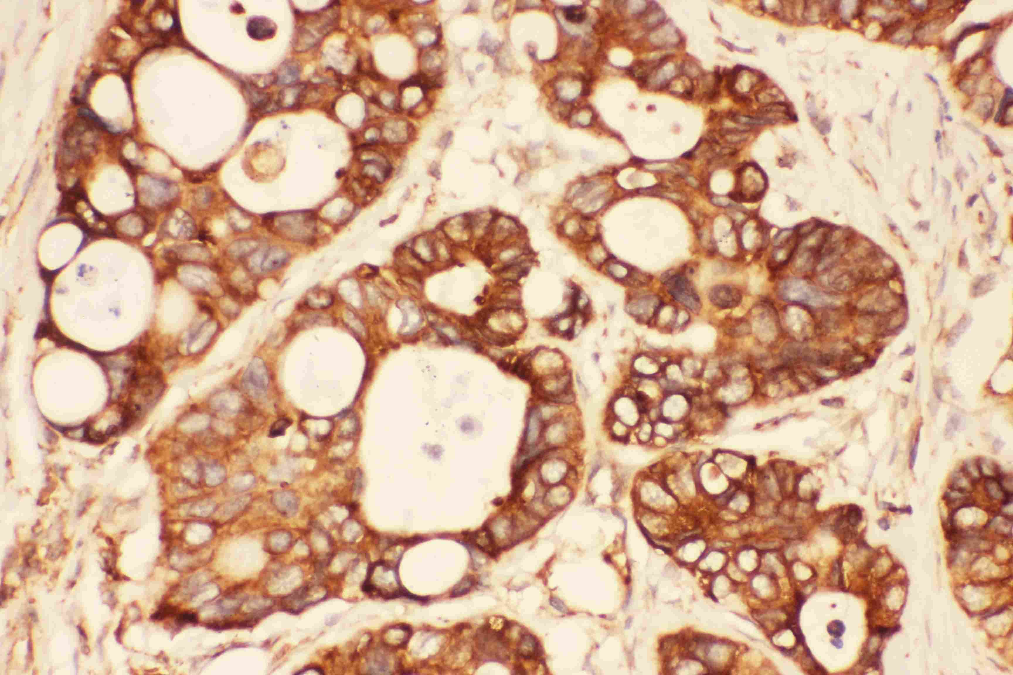 Polyclonal Rabbit anti-Human SRC Antibody (aa2-368, IHC, WB)
