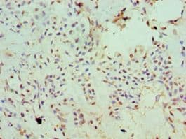 SLC20A2 / PIT2 Antibody (aa235-485)