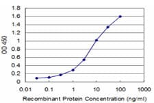MSI1 / Musashi 1 Antibody (clone 4A11)