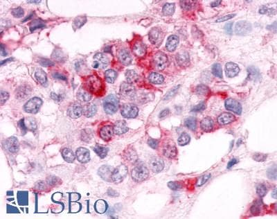 IHC-plus™ ESRRA / ERR Alpha Antibody (Ligand-binding Domain)