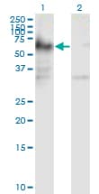 Monoclonal Mouse anti-Human ICA69 / ICA1 Antibody (clone 6G11, WB)