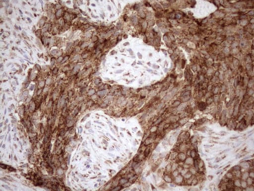 SHMT / SHMT2 Antibody (clone OTI3E9)