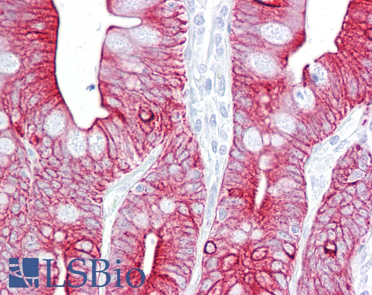 PathPlus™ KRT8 / CK8 / Cytokeratin 8 Antibody (N-Terminus)