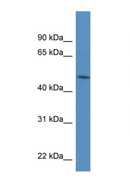 Polyclonal Rabbit anti-Human PDIA6 / ERP5 Antibody (aa108-157, WB)