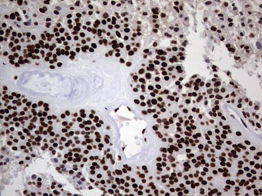 HNRNPL / hnRNP L Antibody (aa270-502, clone OTI9G7, Carrier-free)