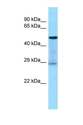 KLK3 / PSA Antibody (aa111-160)
