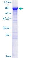 Human DPYSL2 / CRMP2 Protein (Recombinant GST)