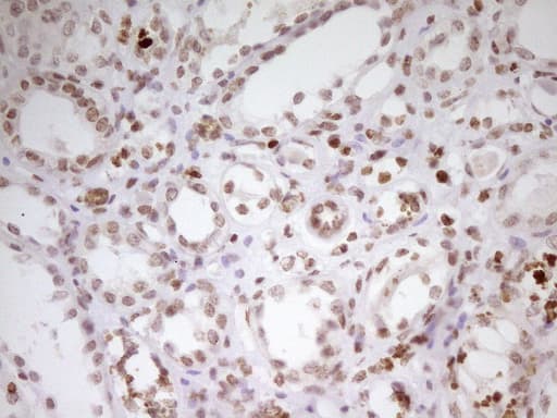 Monoclonal Mouse anti-Human SP110 Antibody (clone OTI4C1, aa232-521, IHC, WB)