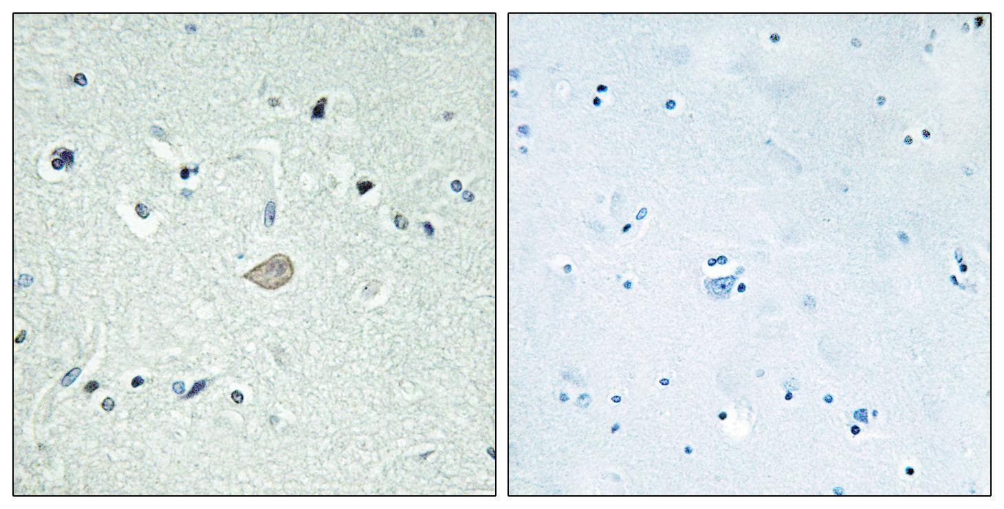 ADGRB3 / BAI3 Antibody