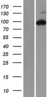 R1 / RRM1 Protein (Over-Expression Lysate Myc-DDK (Flag))