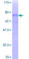 Human ARFGAP1 Protein (Recombinant GST)
