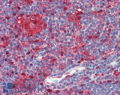 TP / Thymidine Phosphorylase Antibody (aa311-482, clone 7A6, Carrier-free)
