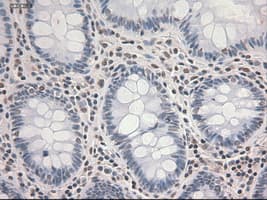 STAT3 Antibody (clone OTI21E7)