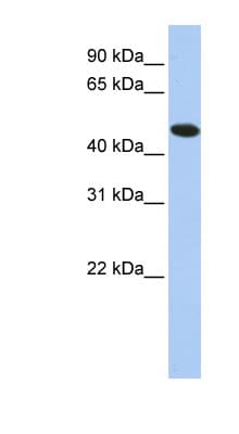 TXNDC5 / ERP46 Antibody (aa36-85)