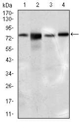 Monoclonal Mouse anti-Human SLC27A5 / BACS Antibody (clone 9C4D1, aa508-570, IHC, WB)