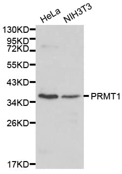 Polyclonal Rabbit anti-Human PRMT1 Antibody (IHC, WB)