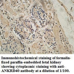 ANKRD40 Antibody (aa126-326)