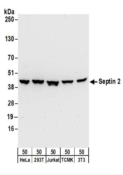Polyclonal Rabbit anti-Human SEPT2 / Septin 2 Antibody (aa311-361, WB)
