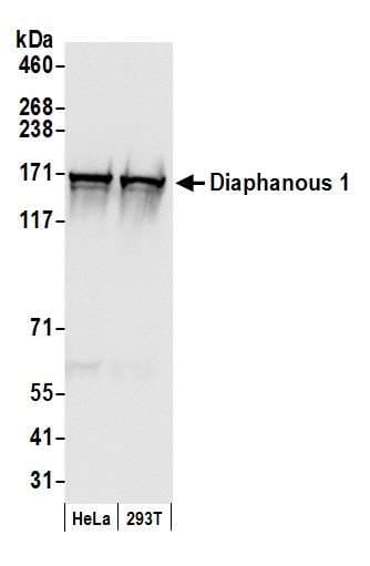 DIAPH1 Antibody (aa1200-C-term)