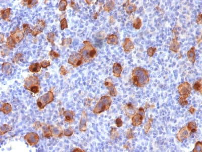 Recombinant Monoclonal Rabbit anti-Human CD30 Antibody (clone Ki-1/1747R, Azide-free,Carrier-free, IHC)