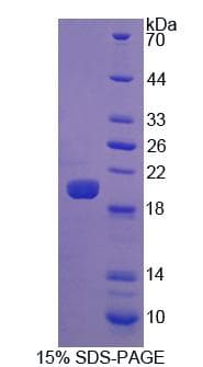 Mouse LPO / Lactoperoxidase Protein (Recombinant His)