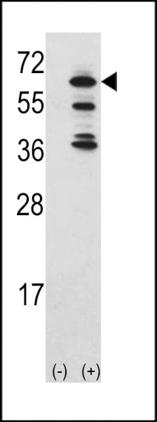 TNK2 / ACK1 Antibody (aa383-411)
