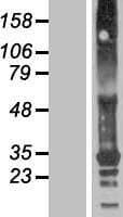 TMEM82 Protein (Over-Expression Lysate Myc-DDK (Flag))