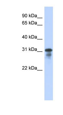 Polyclonal Rabbit anti-Human MED6 Antibody (C-Terminus, WB)